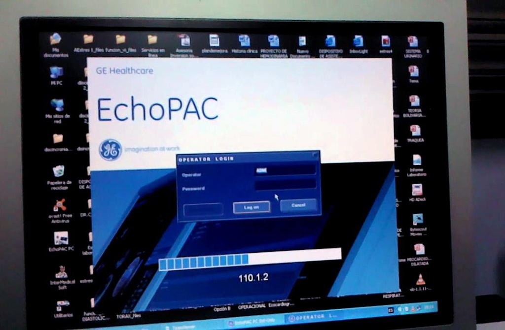 Echo Pac 